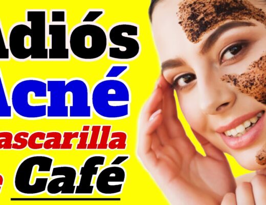 Es malo el café para el acné