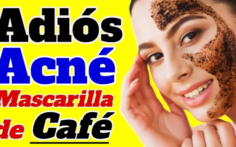 Es malo el café para el acné